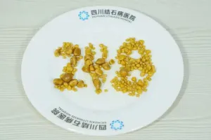 26岁男子三餐吃外卖，胆囊内长出248颗结石
New
