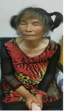 【寻亲启示】六旬老太被救助，穿花色上衣、暗花裤子，扎双马尾-2.jpg