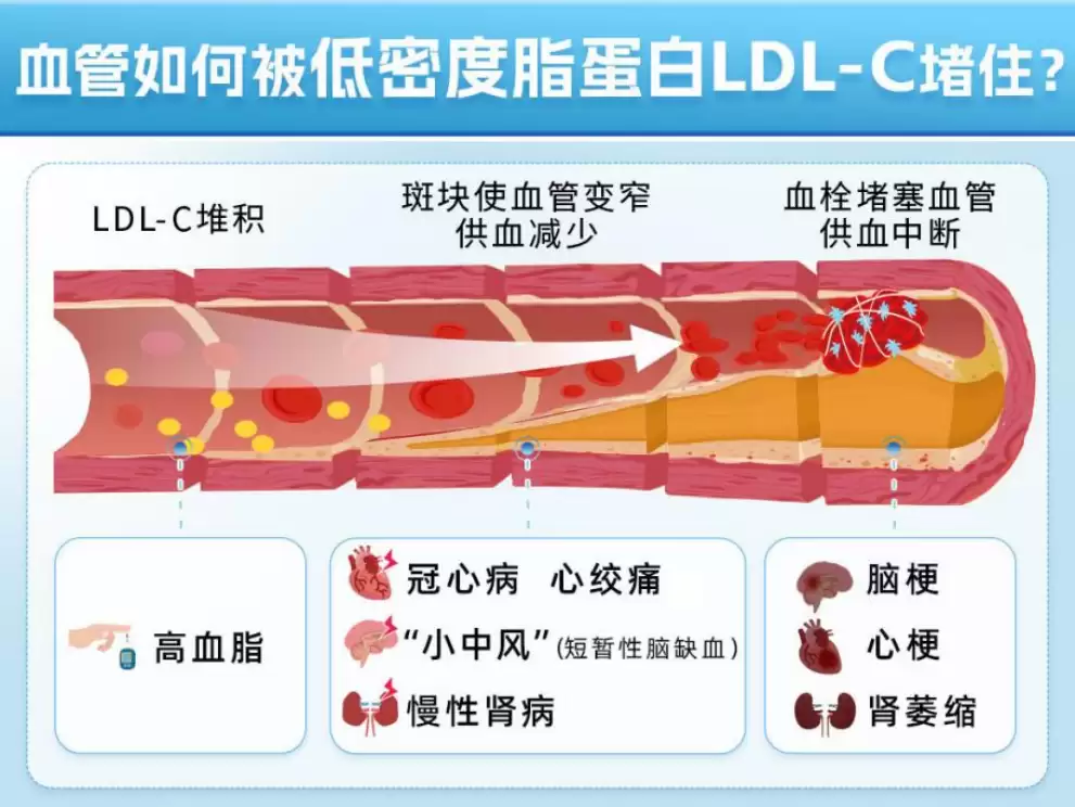 d4.webp